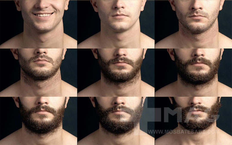 چارت رشد ریش با ماینوکسیدیل