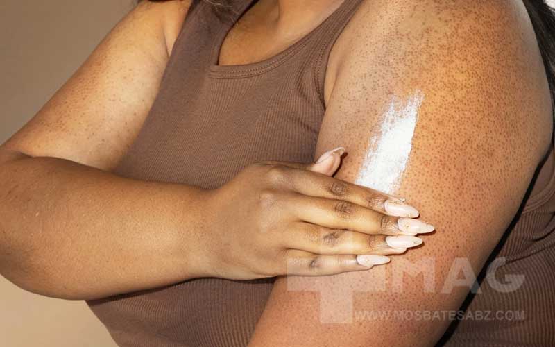 بهترین اسکراب بدن برای پوست مرغی کدام است