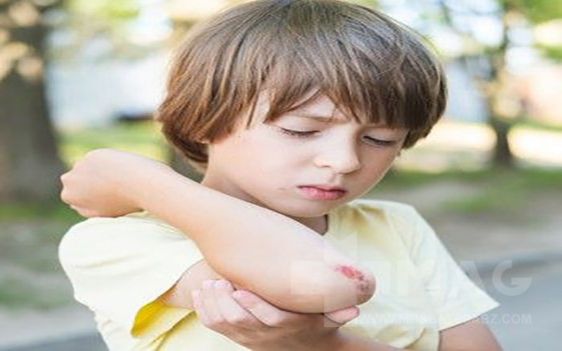 علت دیر خوب شدن زخم کودکان