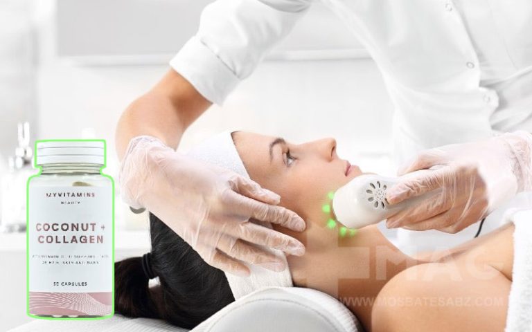 قرص کلاژن بعد از هایفو