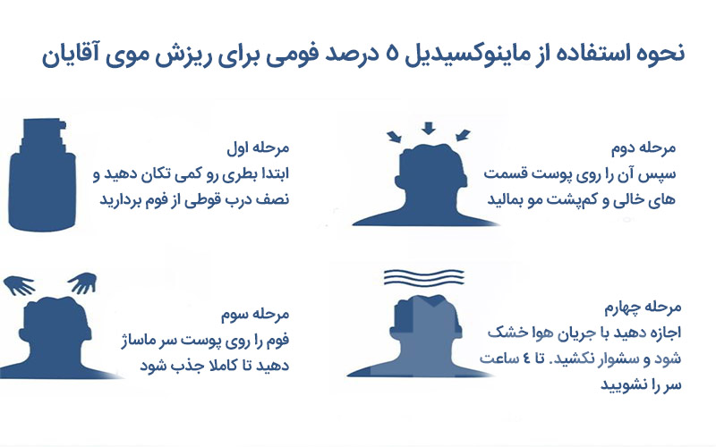 نحوه استفاده از فوم ماینوکسیدیل 5 درصد