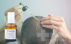 نحوه استفاده از ماینوکسیدیل 5 درصد