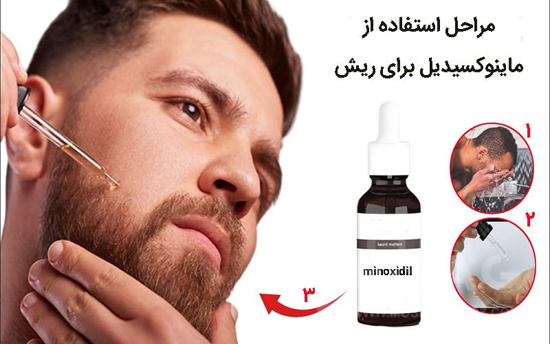 نحوه استفاده از ماینوکسیدیل برای ریش