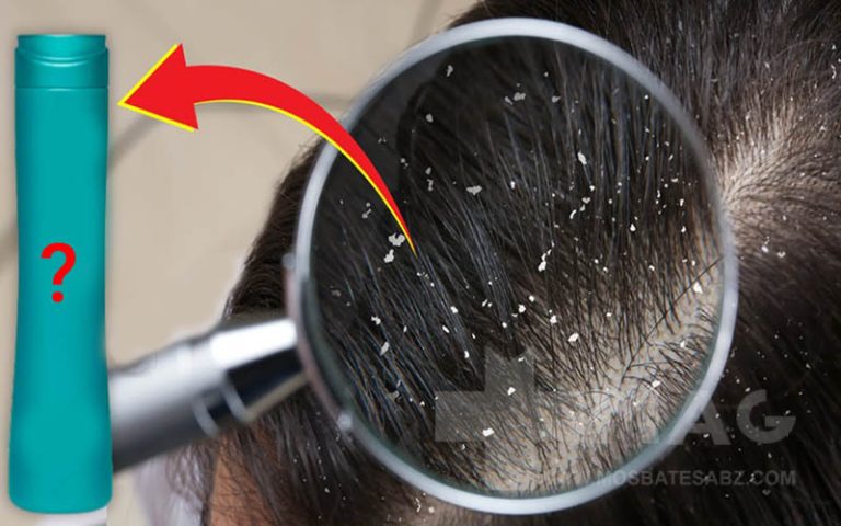 بهترین شامپو ضد شوره مردانه