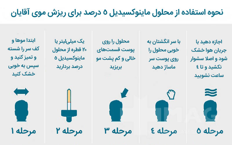 نحوه استفاده از سرم ماینوکسیدیل 5 درصد