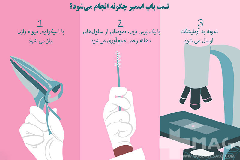 نحوه انجام تست پاپ اسمیر