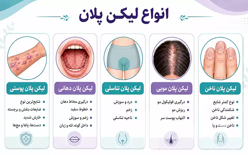 انواع لیکن پلان