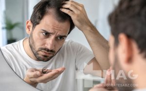 ریزش مو بعد از کاشت