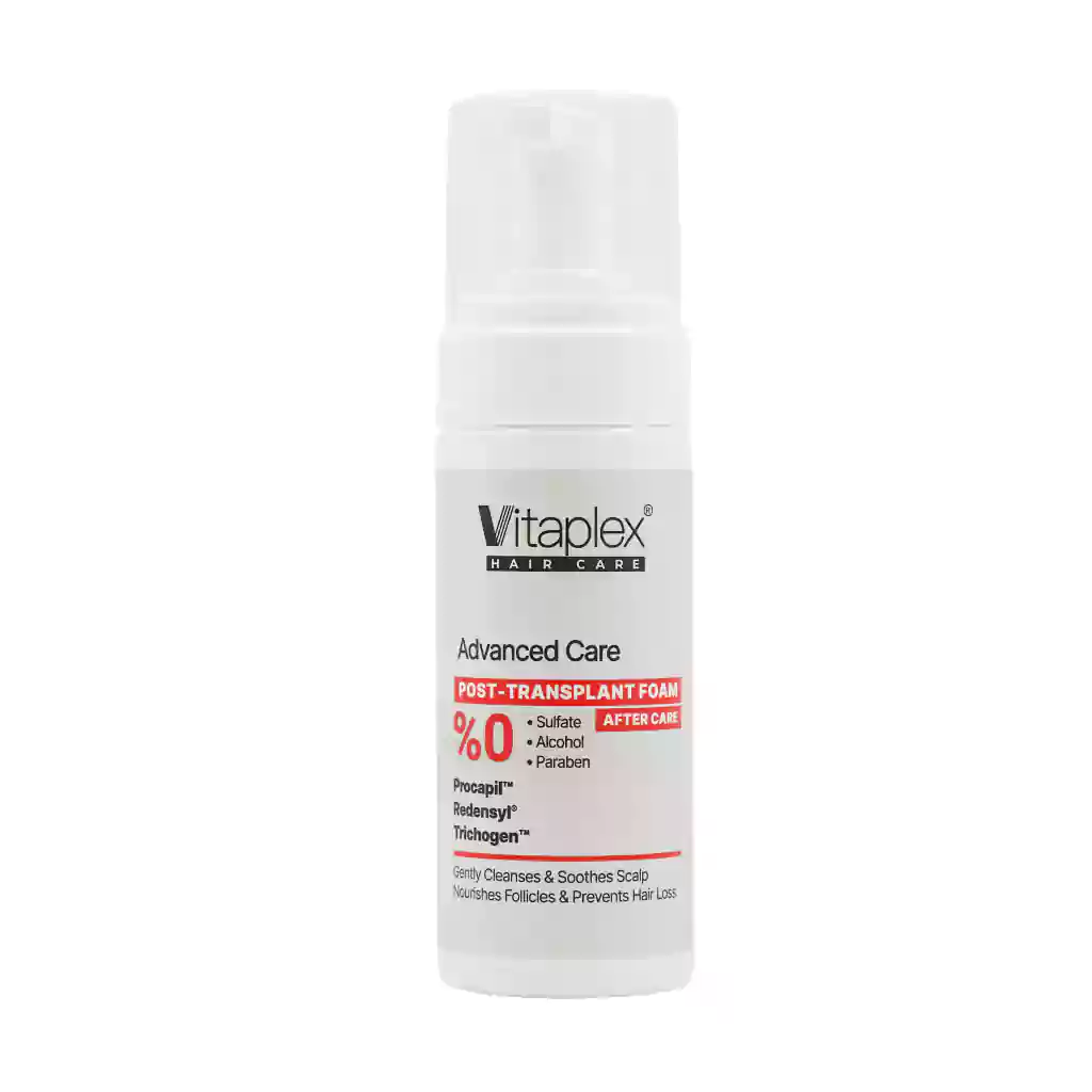 Vitaplex Post Transplant Foam 150 ml قیمت فوم شستشو پس از کاشت مو ویتاپلکس